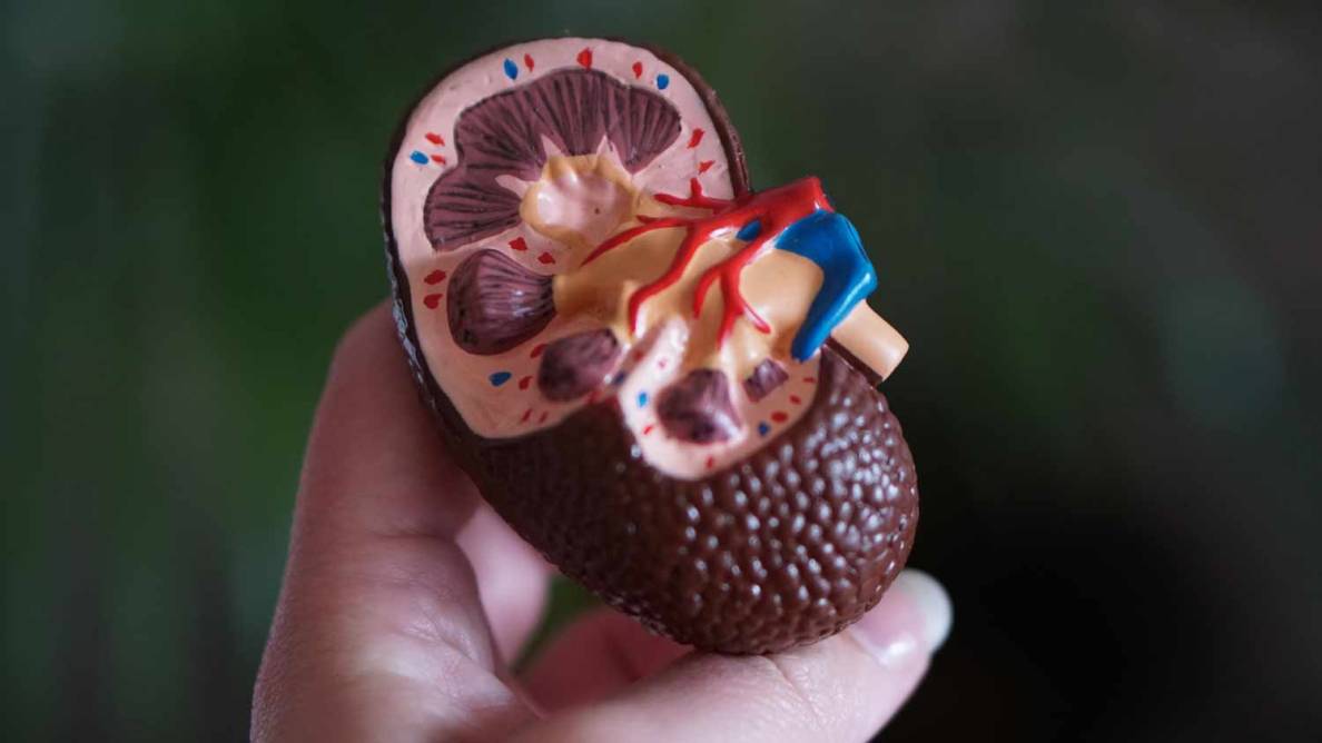 ¿Qué es el cáncer de riñón y cuáles son sus causas?