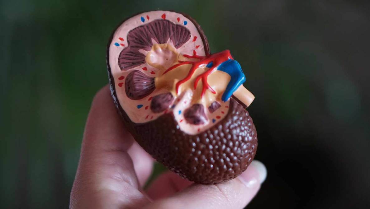 ¿Qué es el cáncer de riñón y cuáles son sus causas?