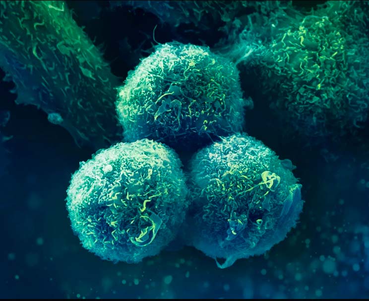 Queremos ayudar a las personas que sufren cáncer