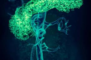 Descubre las principales características de las enfermedades cardiometabólicas